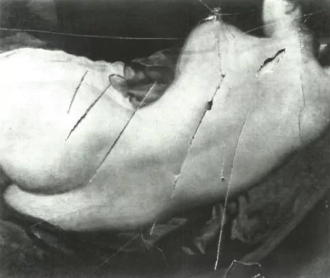 Damage done to the Rokeby Venus by Mary Richardson's attack